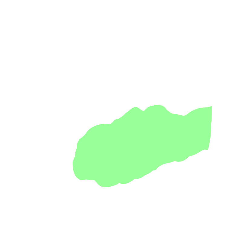 Temporal lobe