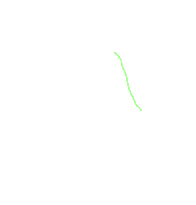 Mylohyoid Line