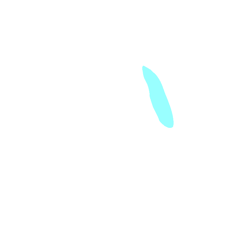 Submandibular Fossa