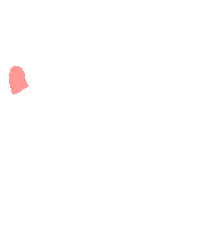 Condylar Process