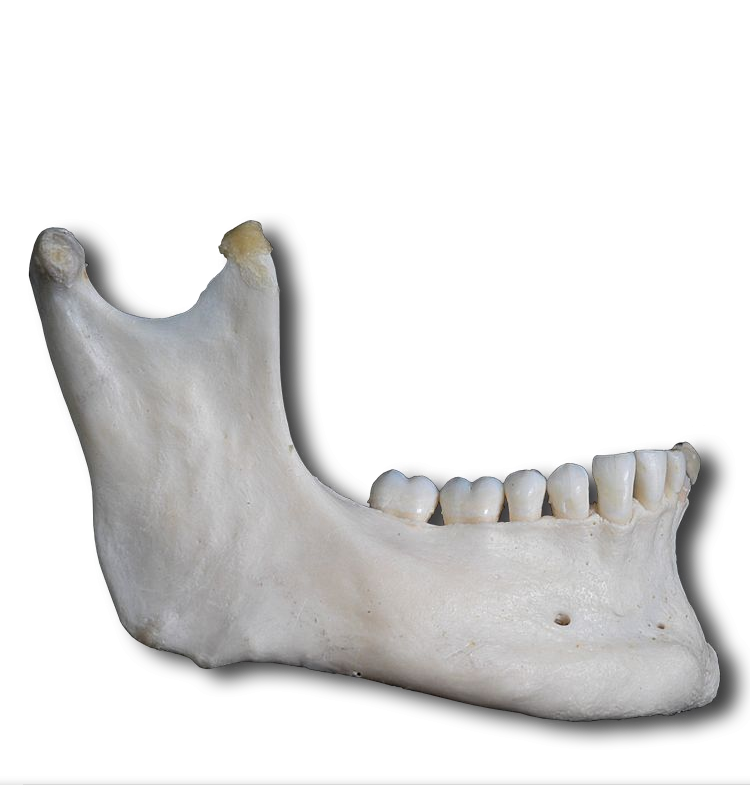 Mandible - Lateral View