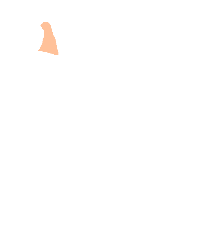 Coronoid Process