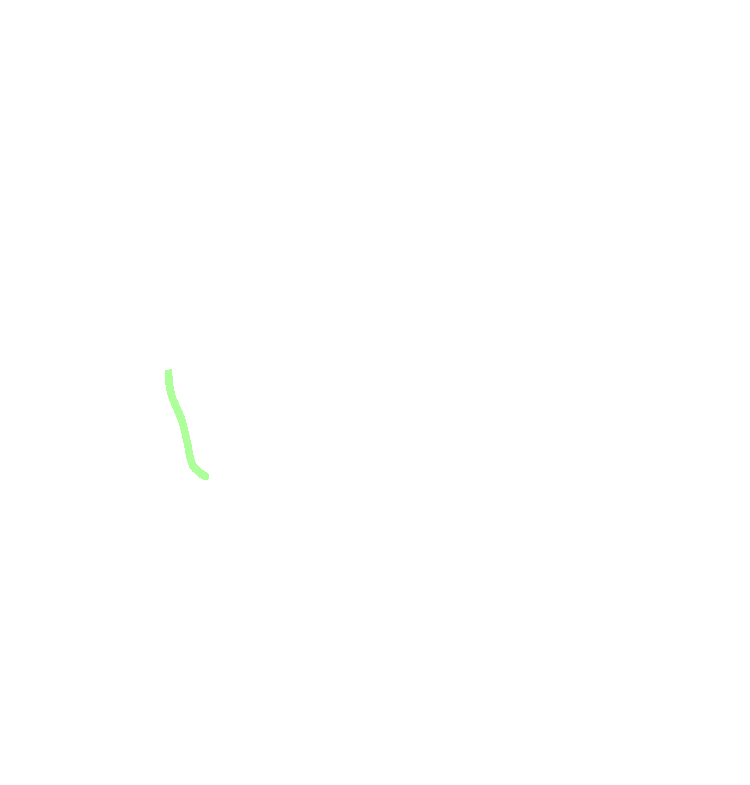 Mylohyoid Groove