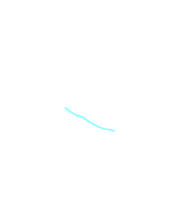 Mylohyoid Line