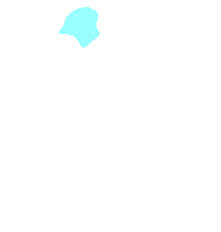 Condylar Process