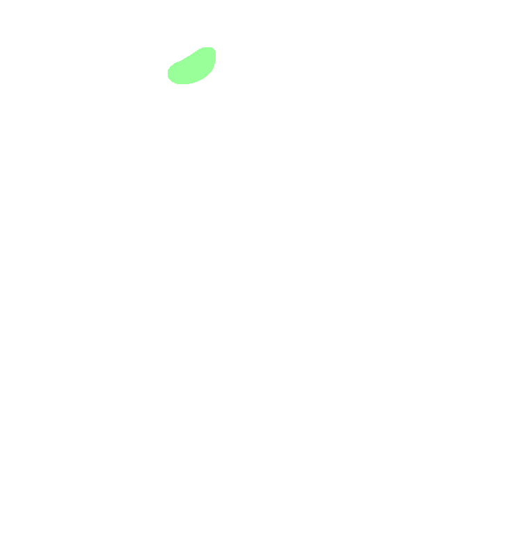 Pterygoid Fovea