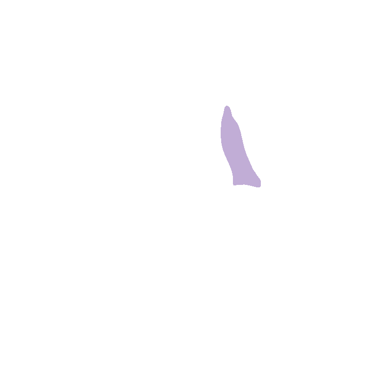Retromolar Fossa