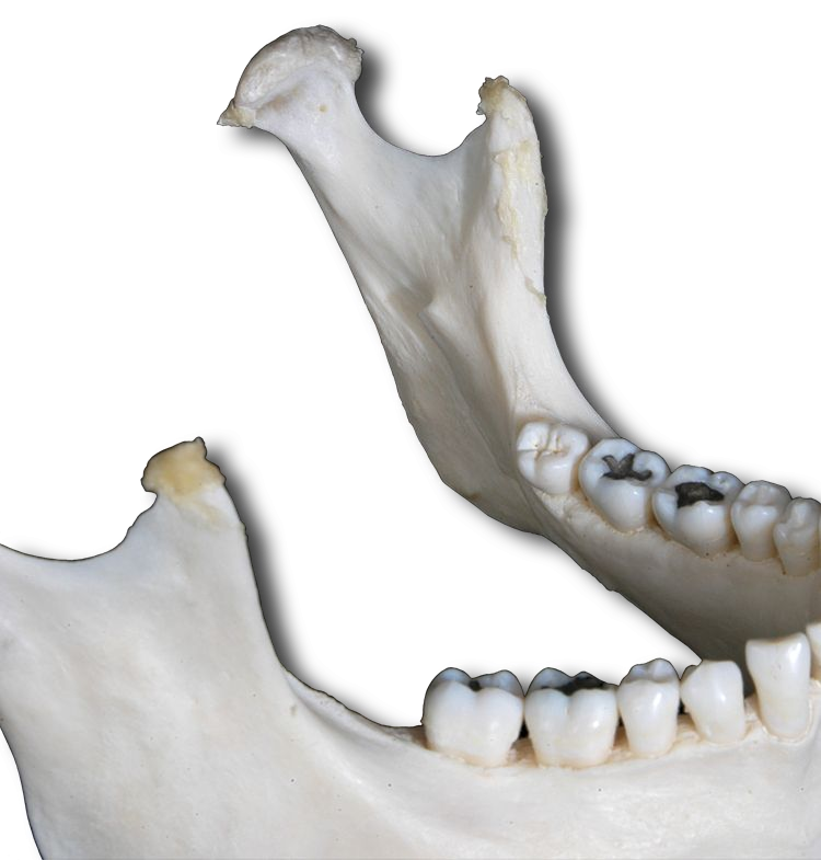 Mandible - Superior View