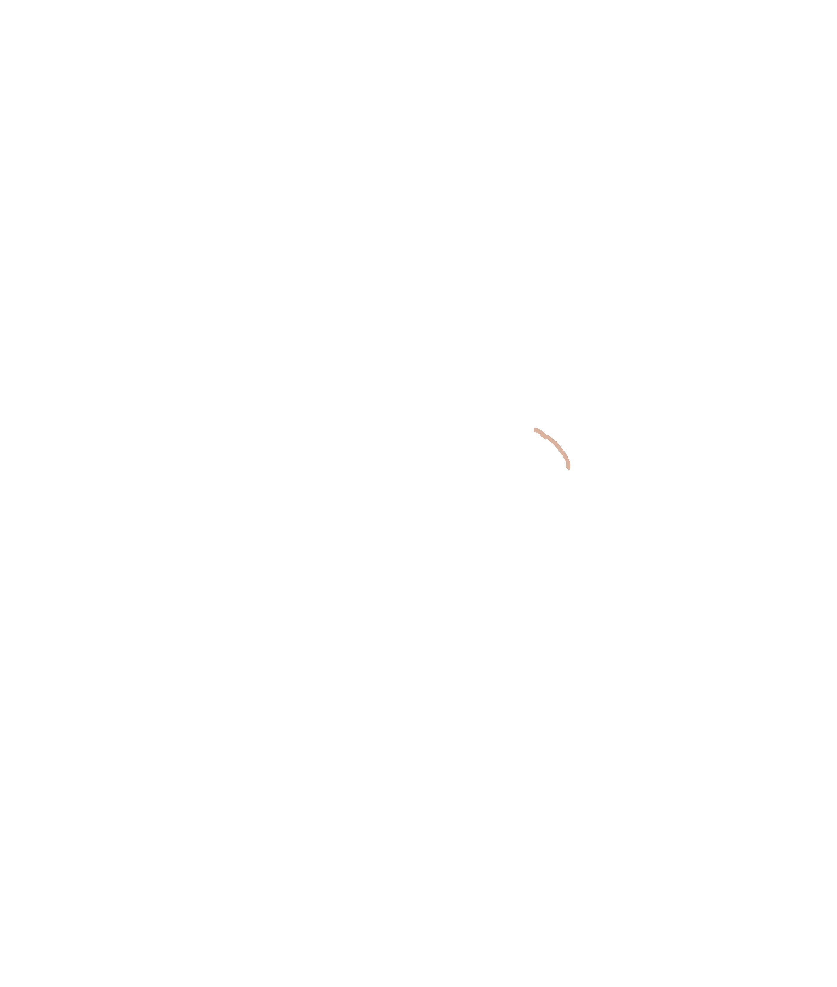Infraorbital foramen