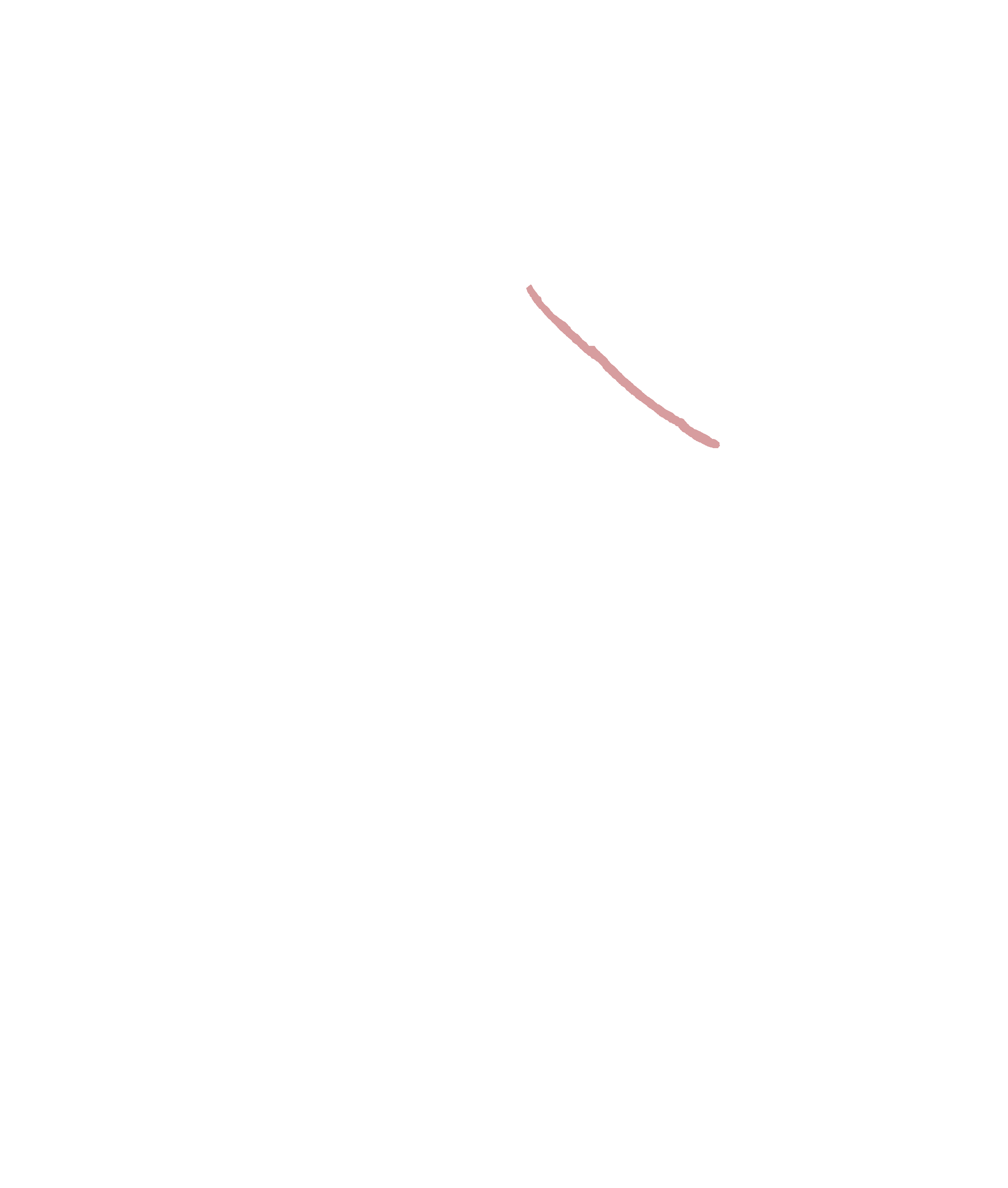 Infraorbital margin