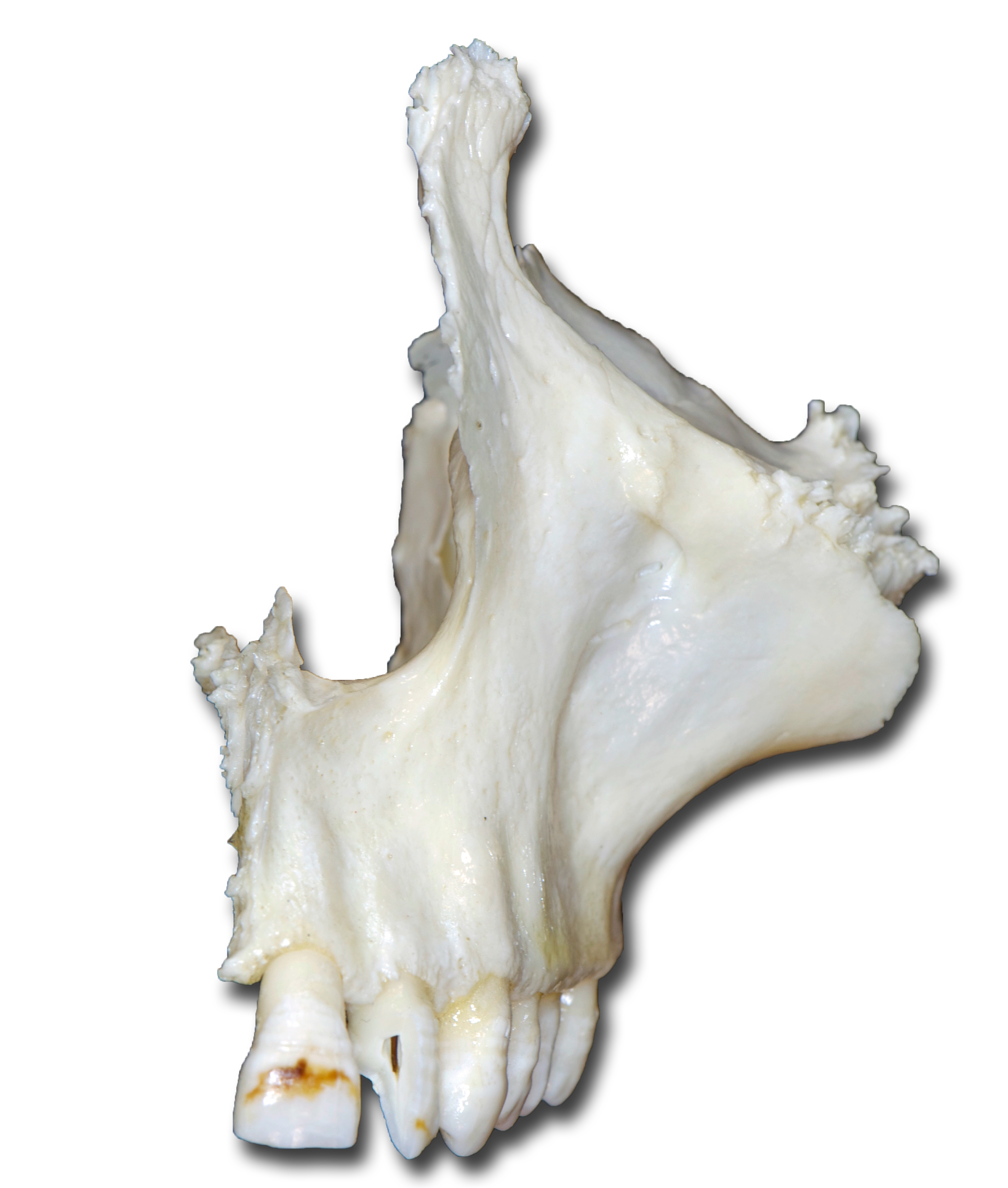 Maxilla left anterior