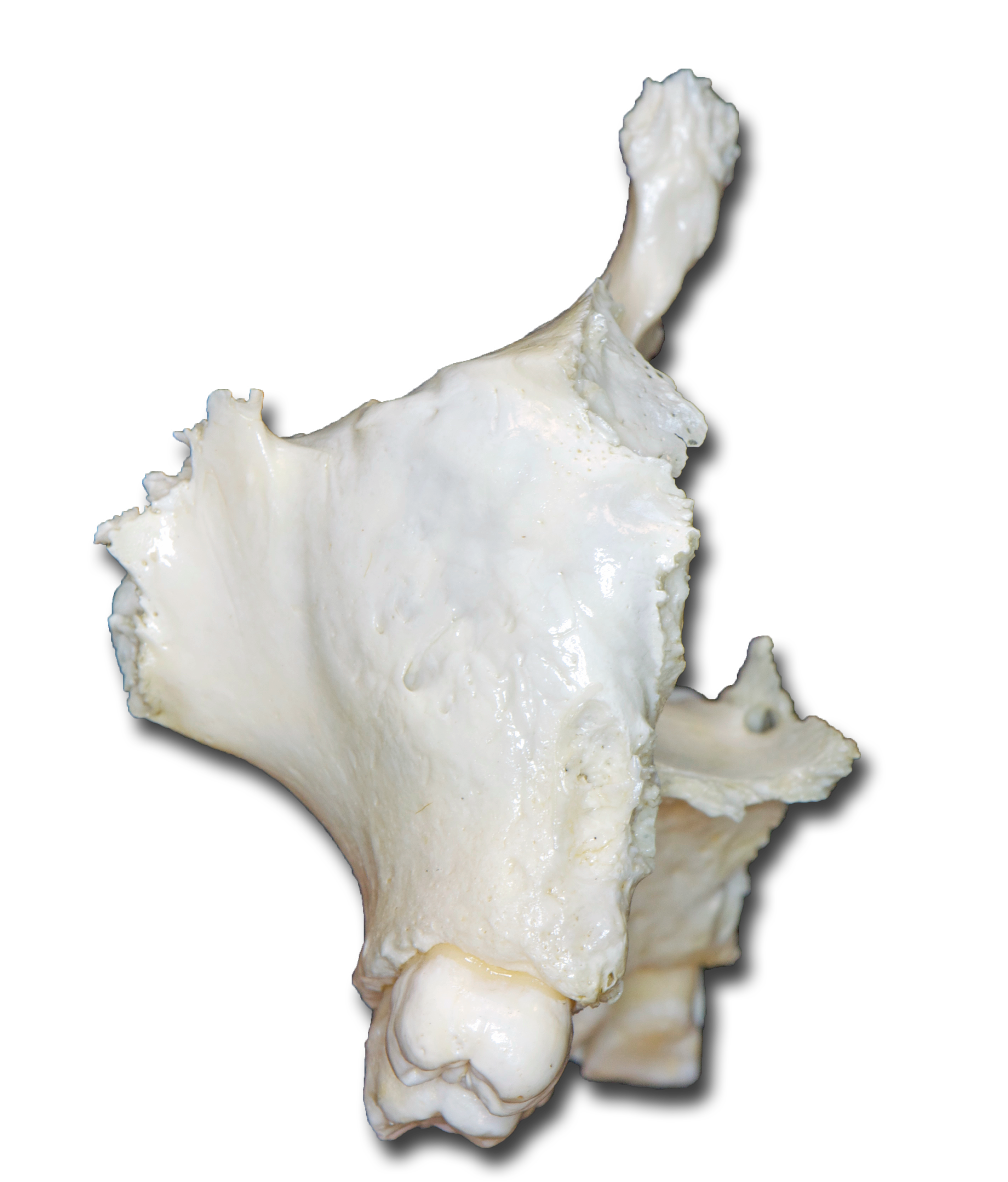Maxilla left posterior