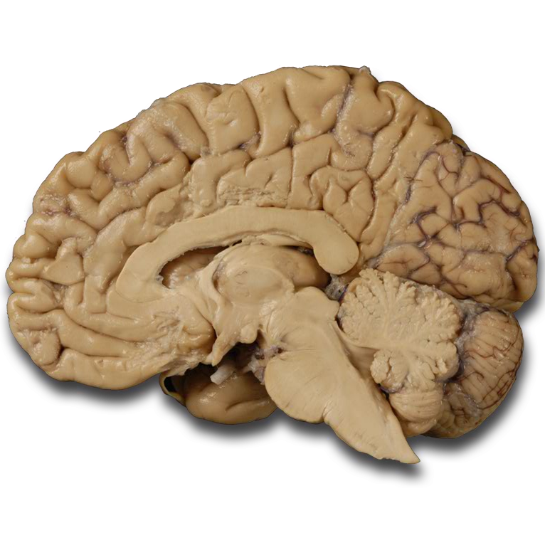 Mid sagittal regions