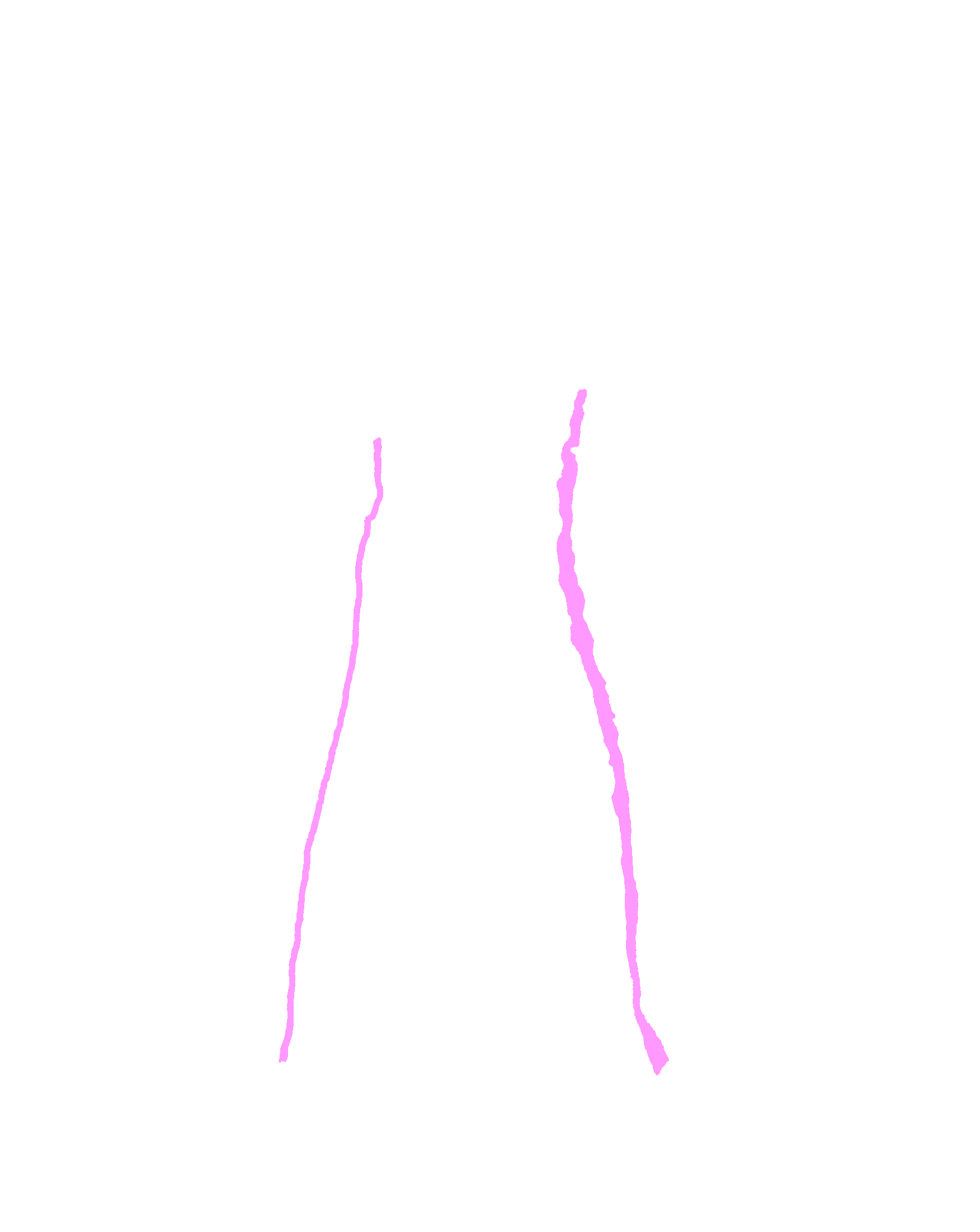 Groove for anterior ethmoidal nerve
