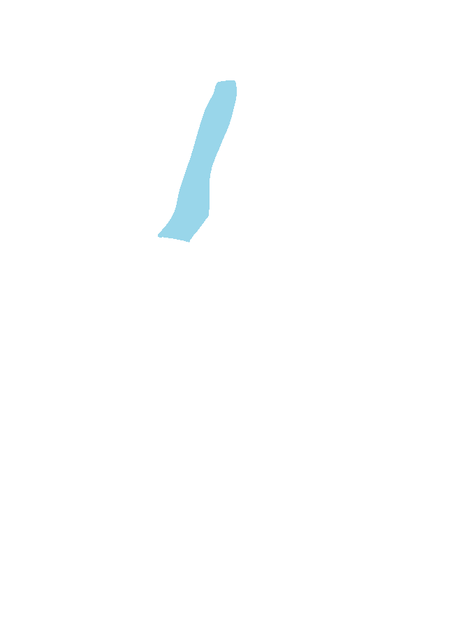 Superior Sagittal Sinus Groove