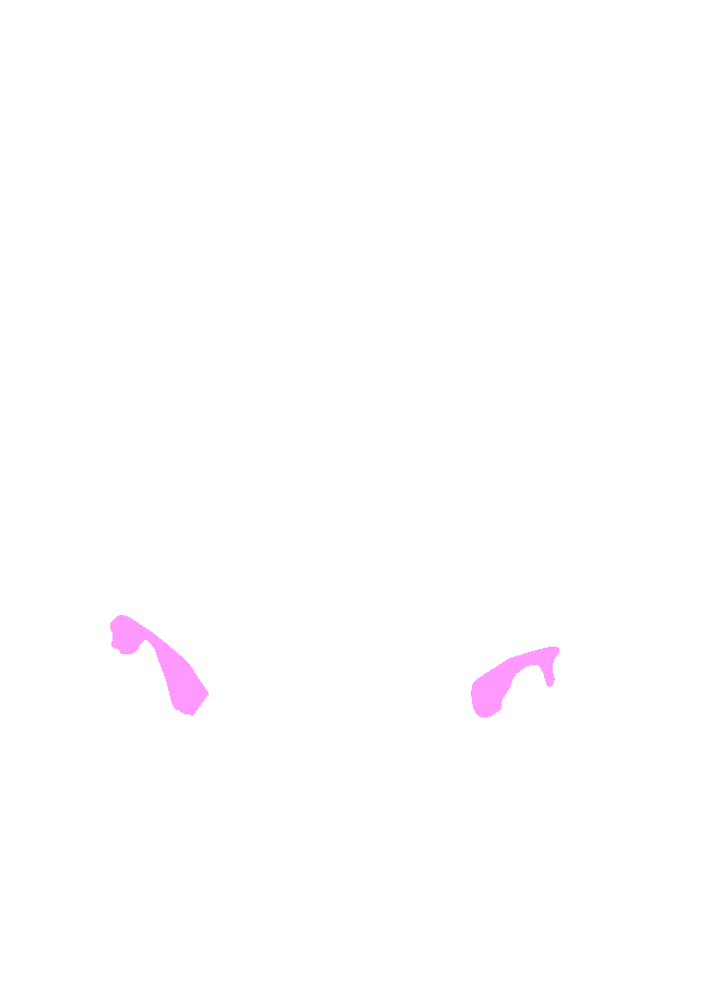Sigmoid Sinus Grooves