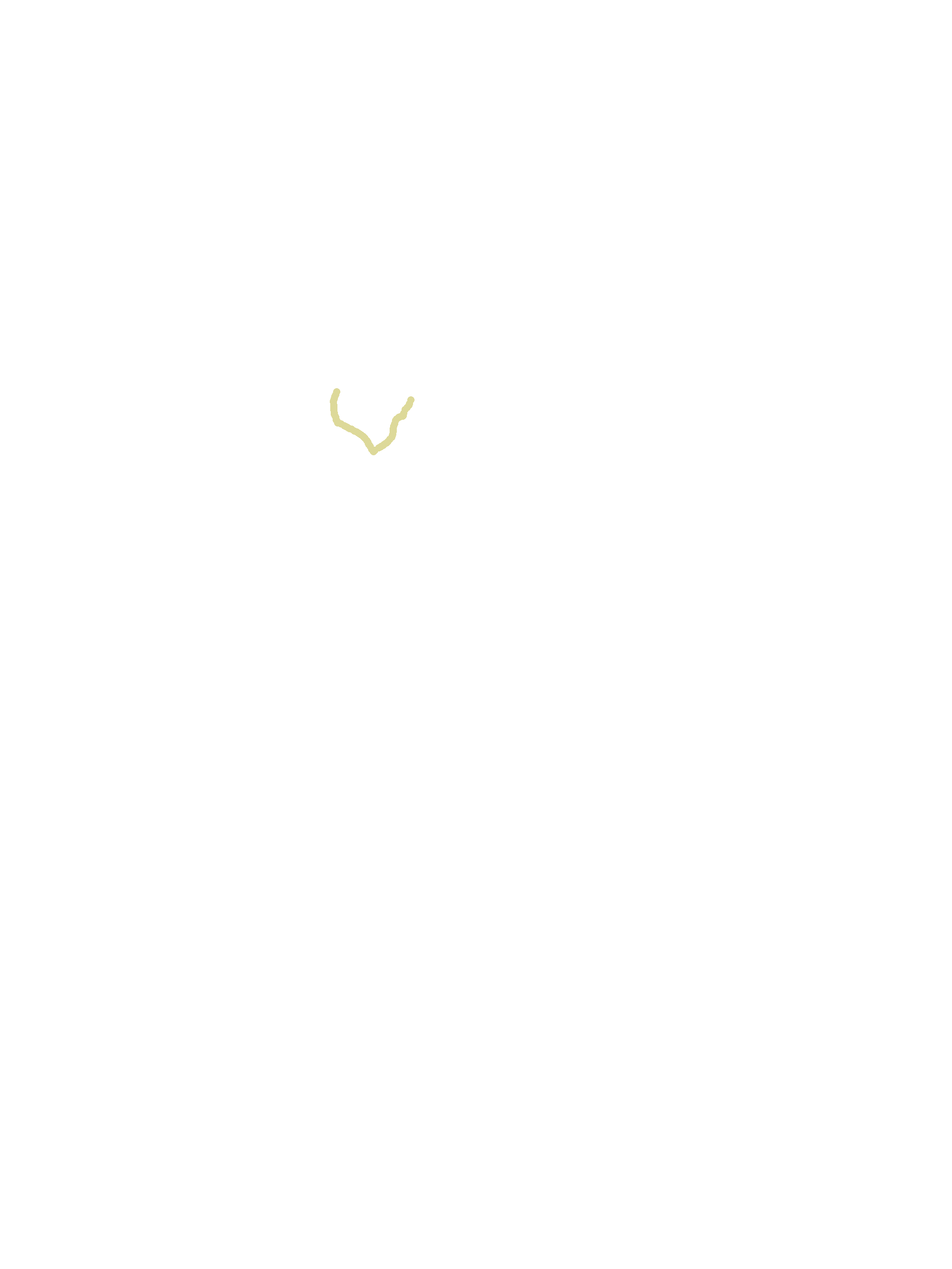 Sphenopalatine Notch