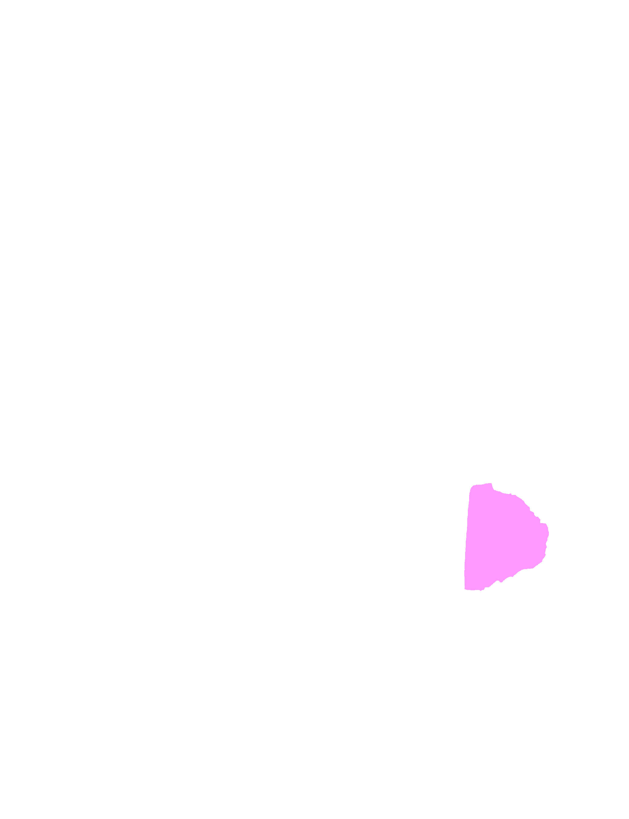 Maxillary Process