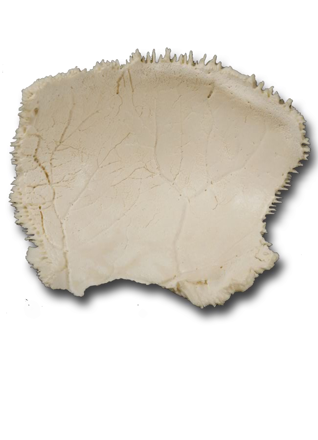 Parietal Bone