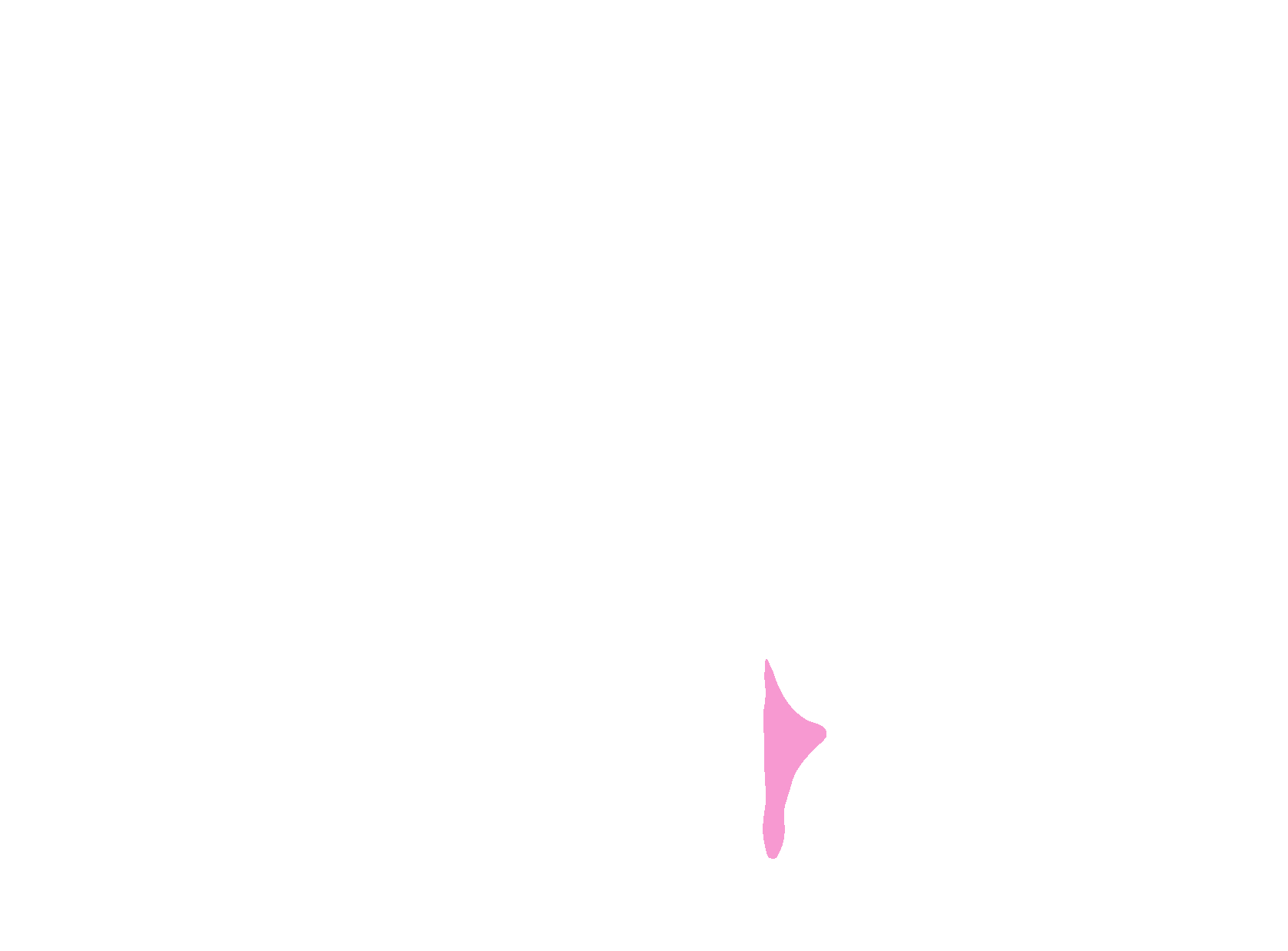 Fourth ventricle