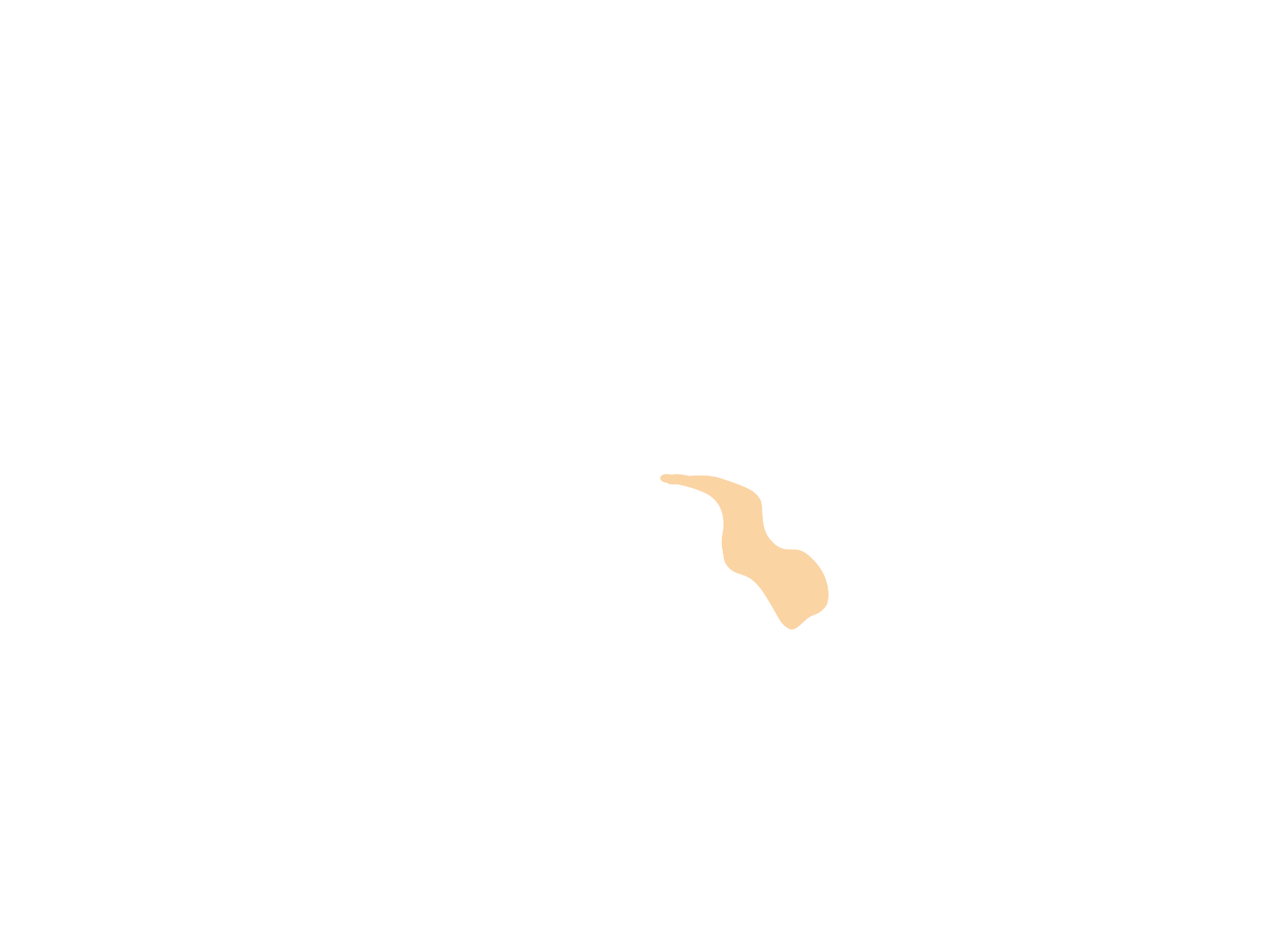 Third ventricle