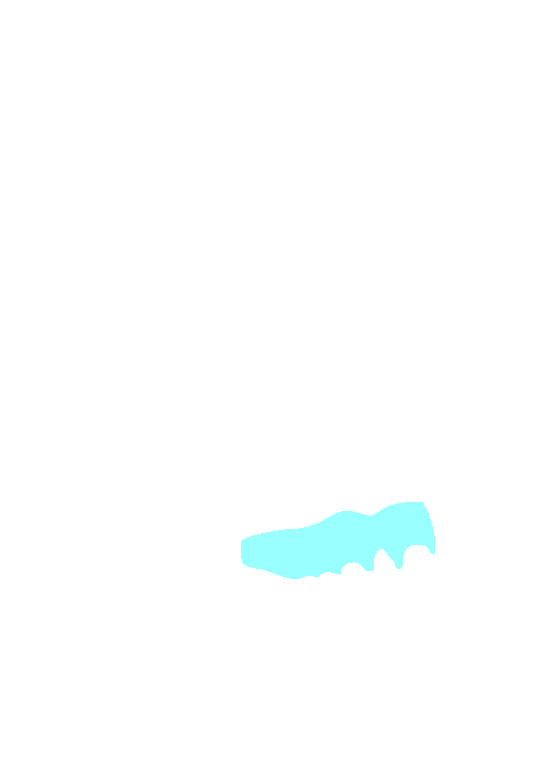 Alveolar process of maxilla