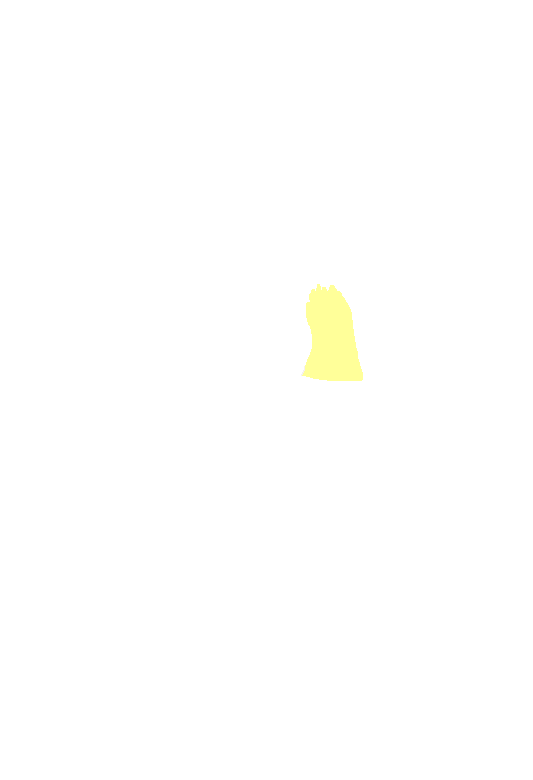 Frontal process of maxilla