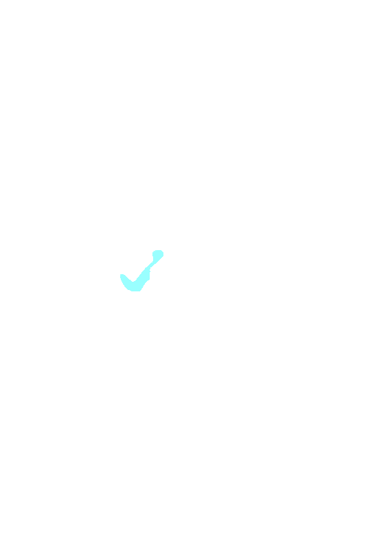 Inferior orbital fissure