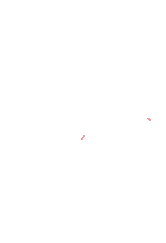 Infraorbital foramen