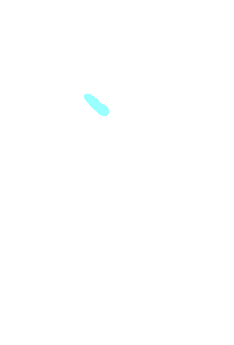 Foramen ovale