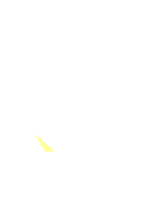 Occipital condyle