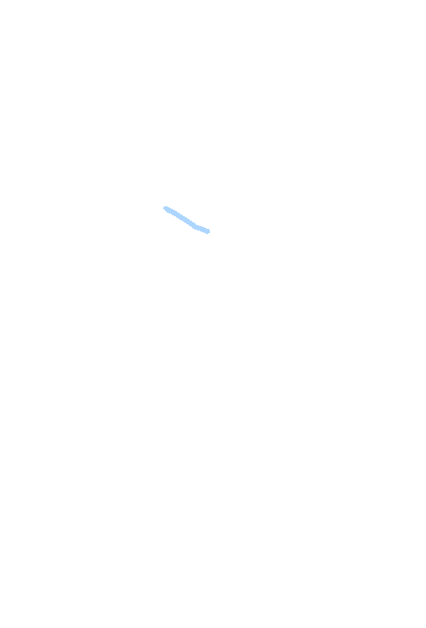 Trigeminal impression