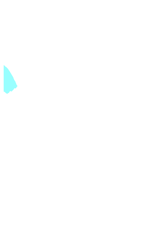 Parietal bone