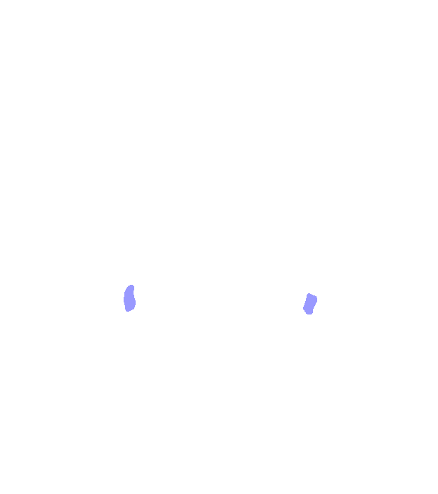 Greater palatine foramen