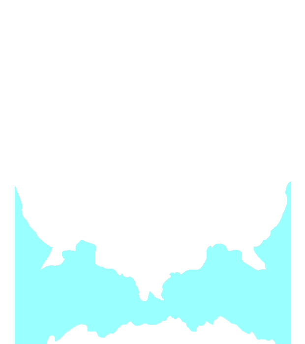 Sphenoid bone