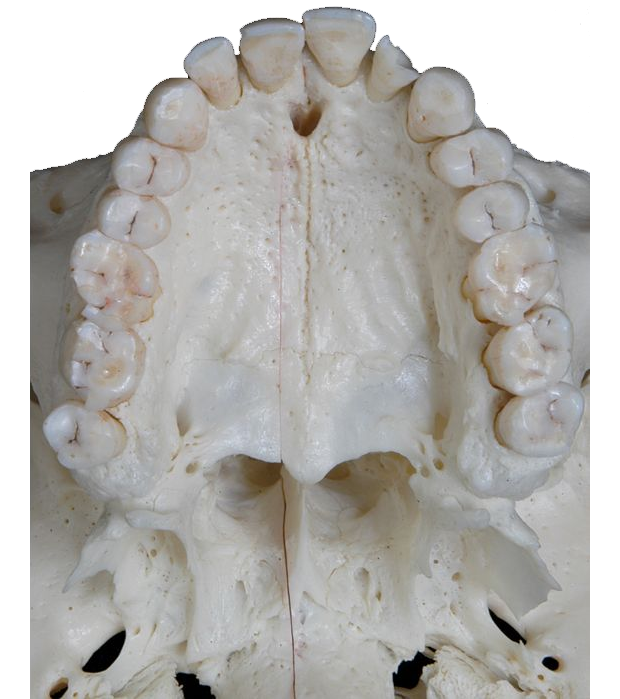 Basal anterior