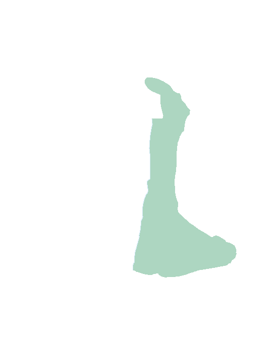 Medial pterygoid plate