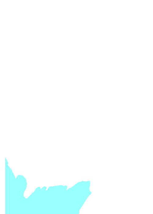 Temporal bone