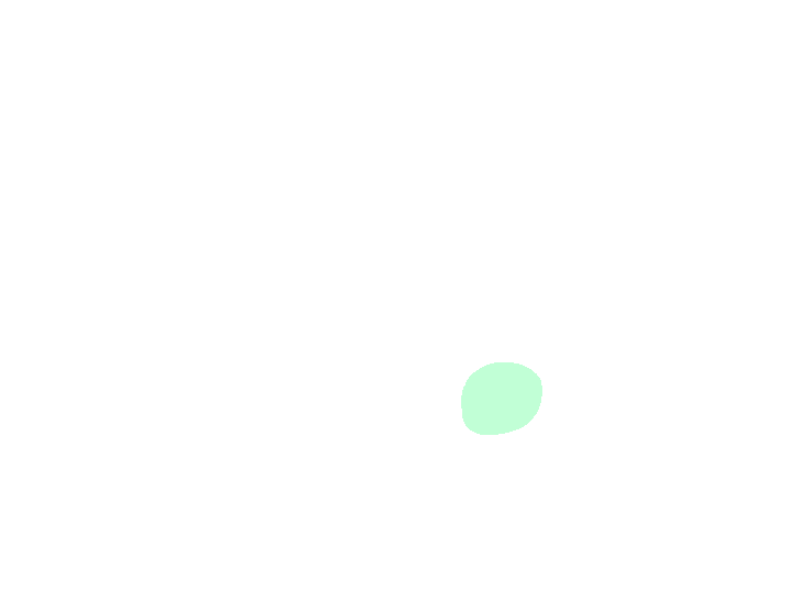 Carotid canal