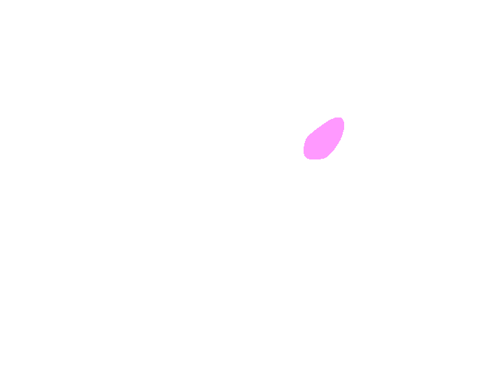 Foramen ovale