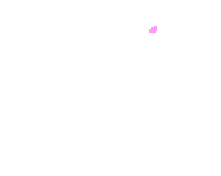 Condylar canal