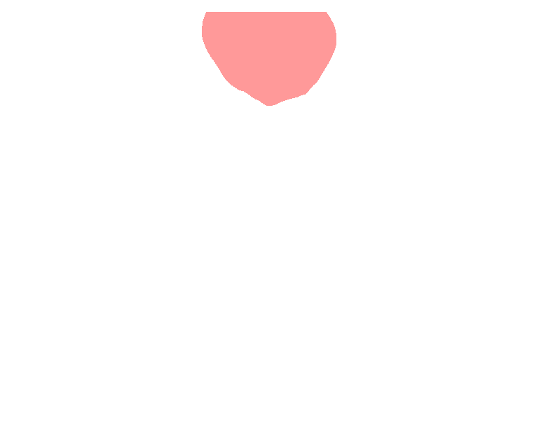 Foramen magnum