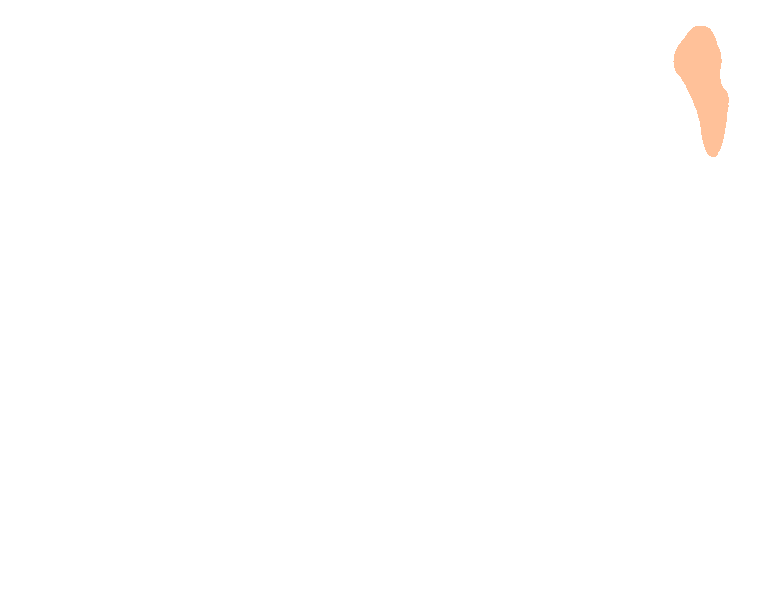 Mastoid notch