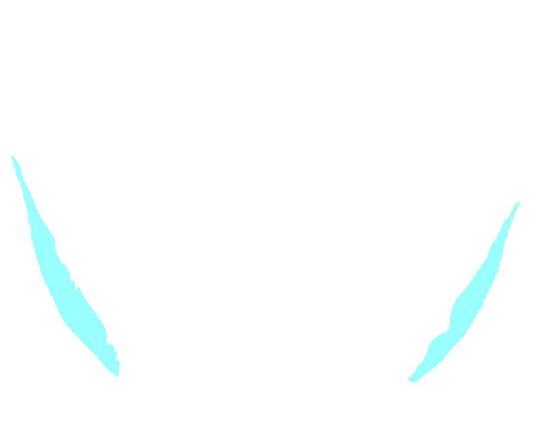 Parietal bone