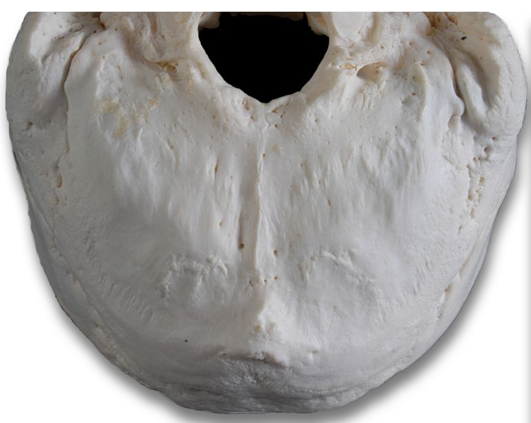 Basal posterior ventral