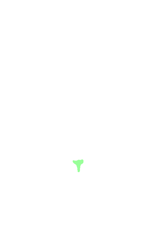 Anterior nasal spine