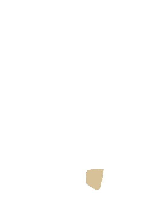 Maxillary tuberosity