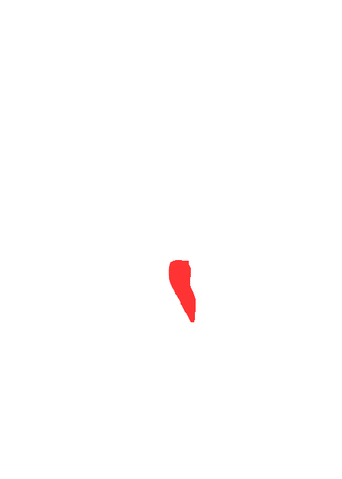 Pterygomaxillary fissure