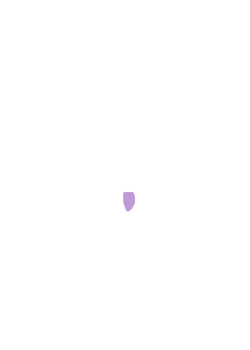 Sphenopalatine foramen