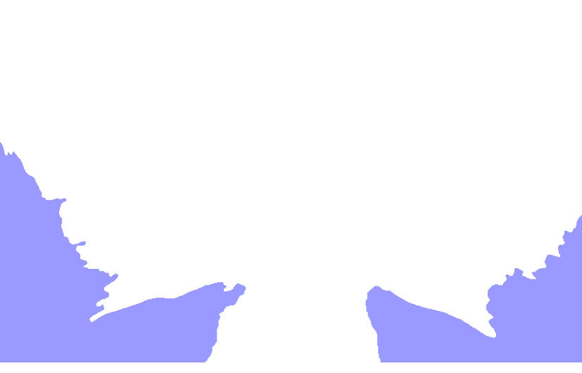 Temporal bone